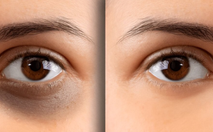 Eye Hospital in Thrissur