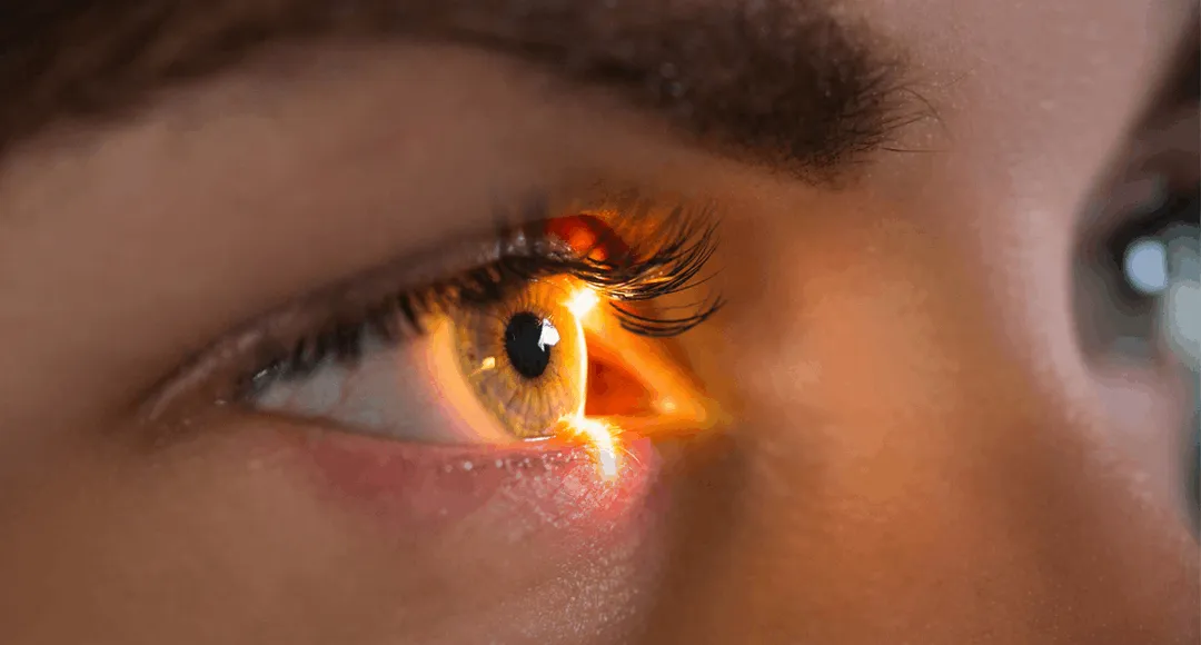 Retina